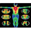 A Deep Dive into Infrared Thermal Imaging